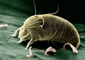 Dust Mites Allergies Car Wash